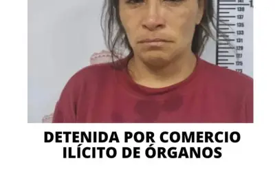 Mulher que vendia rins nas redes sociais é presa na Venezuela